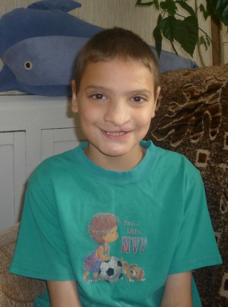 Воспитаннику детского дома успешно сделана пластическая операция.