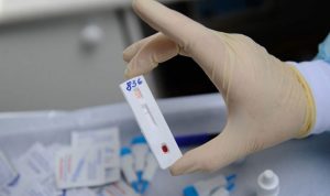 Коронавирус может спровоцировать вспышку ВИЧ-инфекции в России