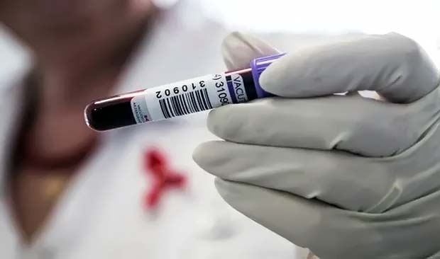 Опасность онкологии при ВИЧ